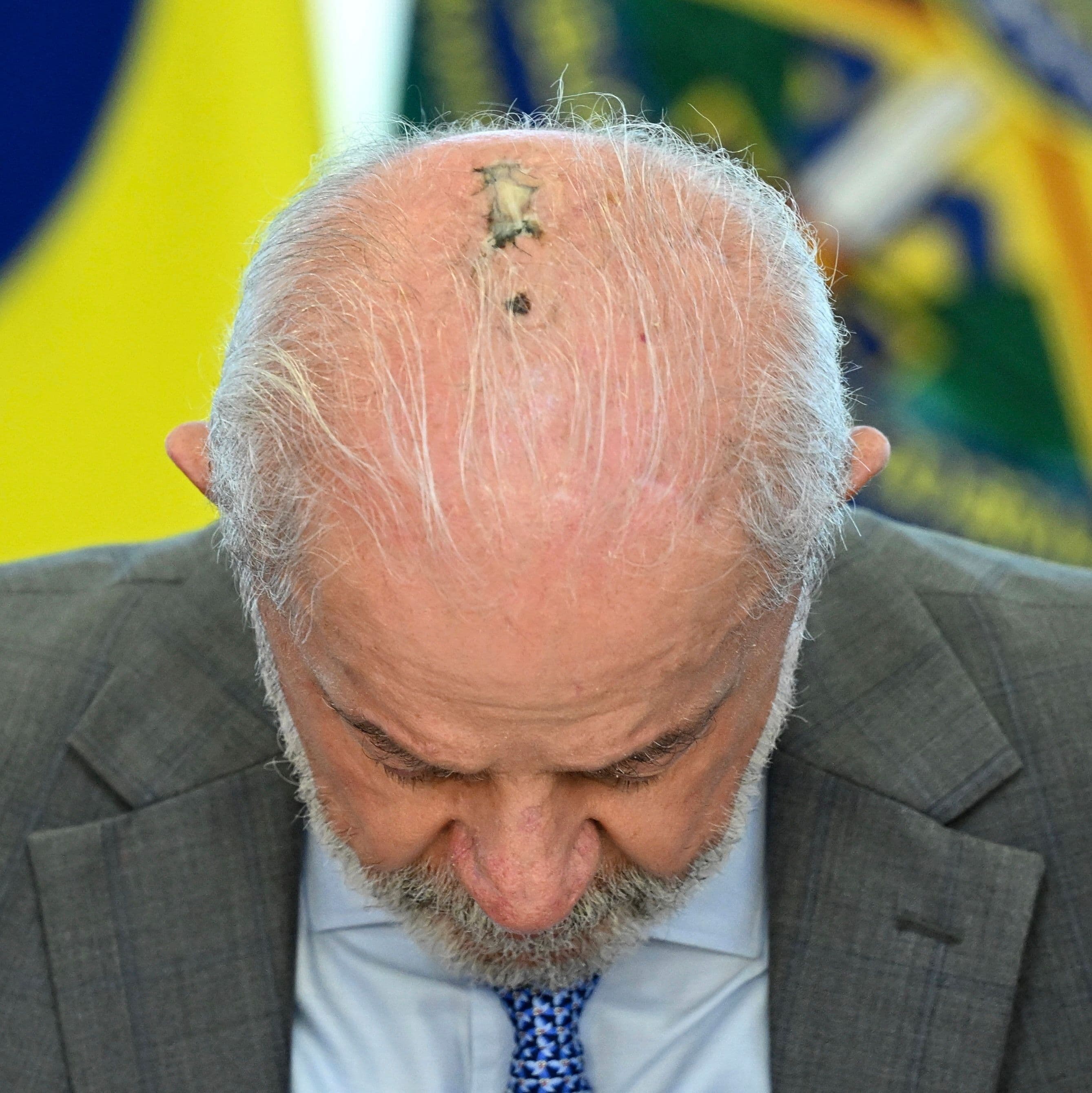 Imagem do artigo: Lula inicia radioterapia após retirada de câncer de pele e segue despachando no Planalto